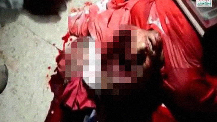 【超！閲覧注意】頭蓋骨が割れ、頭の中が空っぽになった男性のグロ動画。