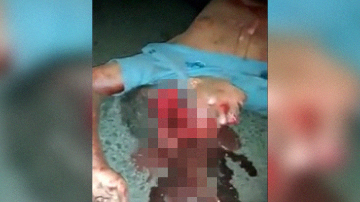 【閲覧注意】バイク転倒により、頭がパカッと割れて死亡した男性のグロ動画。