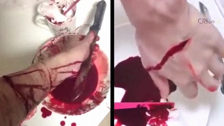 【閲覧注意】リストカットして血が流れる様子を撮影した映像まとめ。