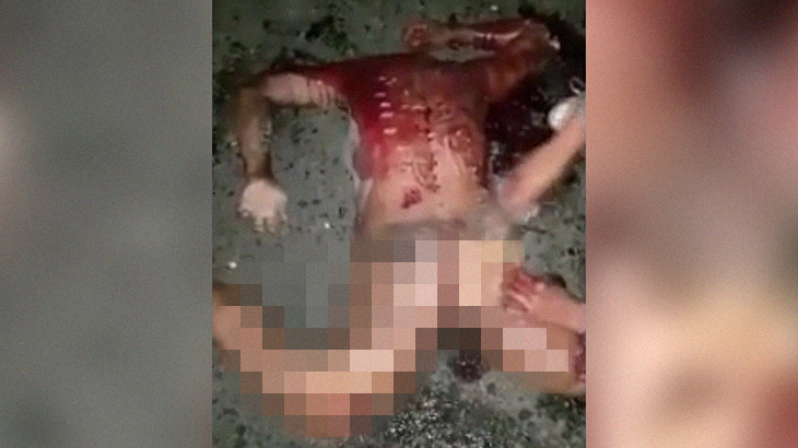 【閲覧注意】死んだ人間からお尻の肉を剥ぎ取るグロ動画。