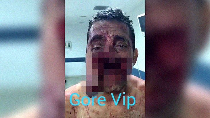 【超！閲覧注意】まるで “プレデターのように” 口が開いてしまった男性のグロ動画･･･。