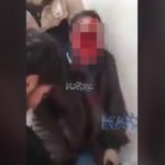 【閲覧注意】爆撃に巻き込まれて顔が無くなってしまった男、これでもまだ生きている･･･。