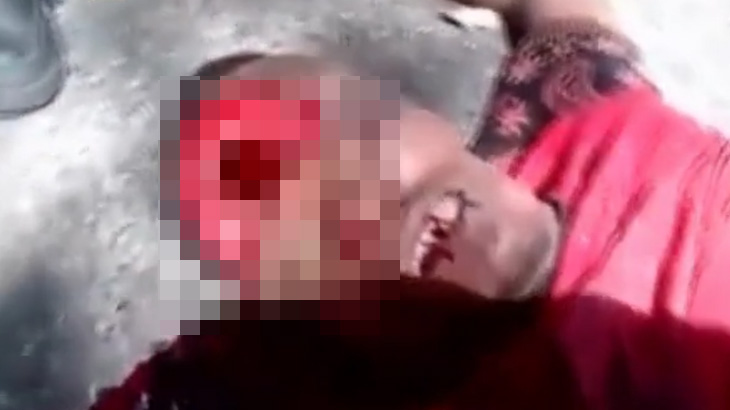 【閲覧注意】事故で頭がパカッと割れて死んだ男、中身空っぽ･･･。