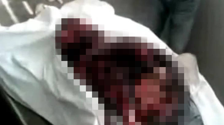 【閲覧注意】爆破により上半身が吹き飛ばされてしまった男のグロ動画･･･。