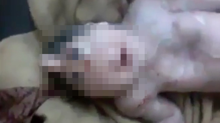 【閲覧注意】ヤバい赤ちゃんが産まれてしまう･･･。