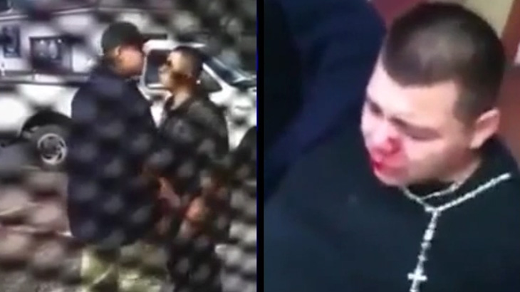 体格の良い男、小柄な男にワンパンKOされてしまう。