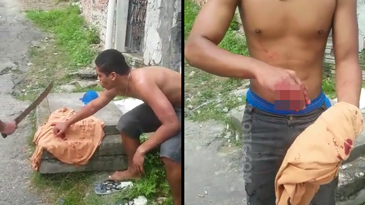 【閲覧注意】罪を犯した男、小指をマチェーテで切断されてしまう･･･。