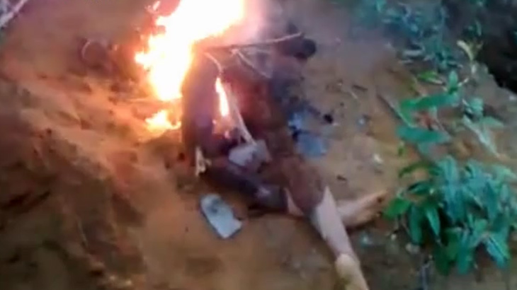 【閲覧注意】実の父親とセックスしていた14歳の女の子、彼氏に燃やされてしまう･･･。