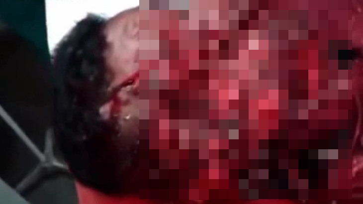 【閲覧注意】マチェーテで顔をズタズタにされてしまった男のグロ動画･･･。