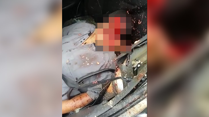 【閲覧注意】事故により顔が無くなってしまった男のグロ動画･･･。