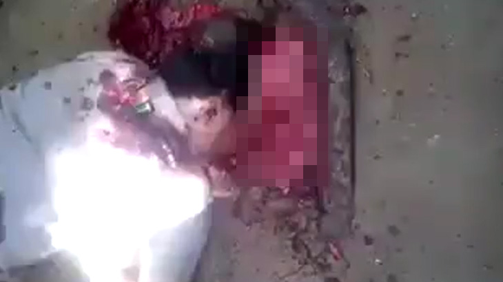 【閲覧注意】割れた頭から “脳がまるごと” 外に飛び出て死んだ男のグロ動画。