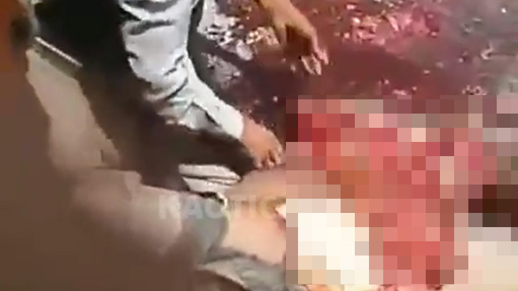 【超！閲覧注意】身体グッチャグチャになってしまった男のグロ動画･･･。