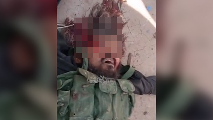 【閲覧注意】こめかみを銃で撃たれた男の顔、怖すぎる･･･。