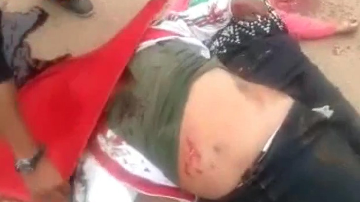 【超！閲覧注意】”顔が破裂” して死んだ夫婦のグロ動画･･･。