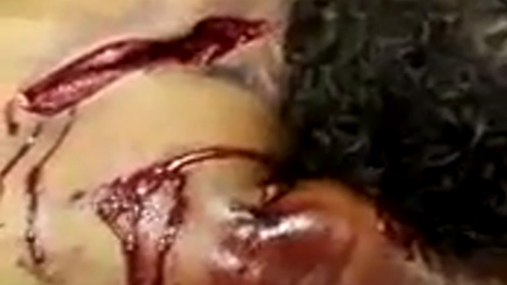 【閲覧注意】娘をレイプされた母親、犯人の男をマチェーテでズタズタにしてしまう･･･。