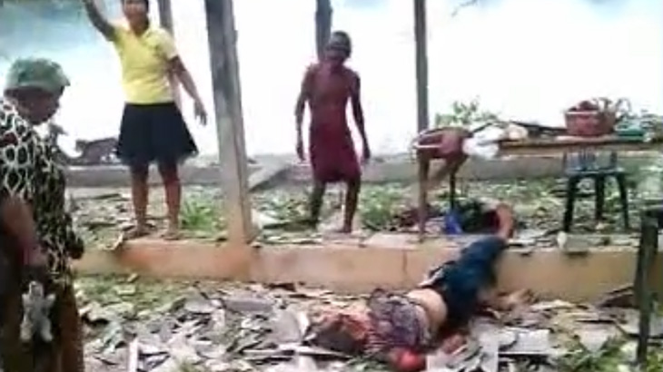 【閲覧注意】バーベキューしていた家族、爆発により多数の負傷者が･･･。