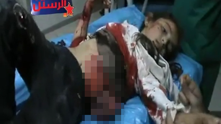 【閲覧注意】空爆を受けた女の子、腹から内臓が飛び出してしまう･･･。