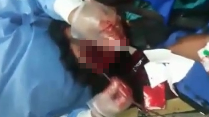 【閲覧注意】爆撃を受けて顔が割れてしまった男の手術映像。これ助かるのか･･･？