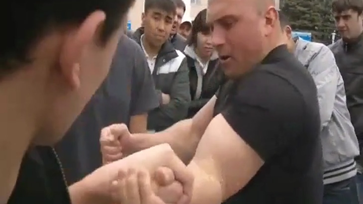 筋肉ムキムキの男性、腕相撲で肘が折れてしまう･･･。