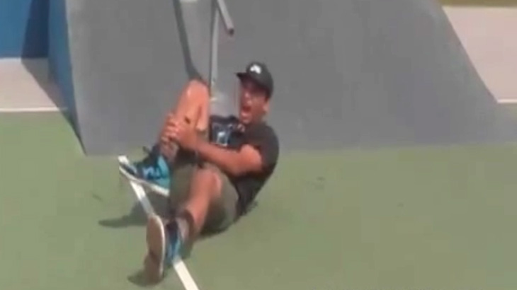 【閲覧注意】スケボーに失敗した男、右足を骨折してしまう･･･。