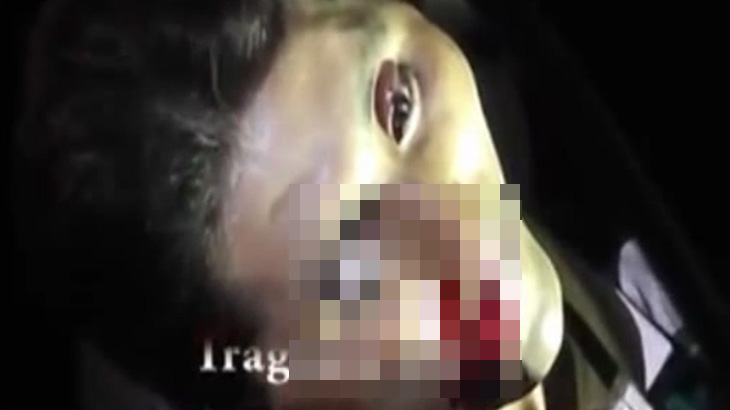 【閲覧注意】夫に散弾銃で撃たれた妻、右目が飛び出してしまう･･･。