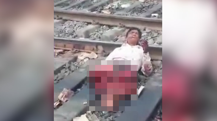 【閲覧注意】列車に両脚を切断されてしまった男のグロ動画。