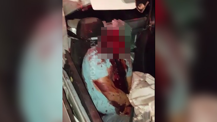 【閲覧注意】自動車事故で頭部がまるごと無くなってしまった男のグロ動画･･･。