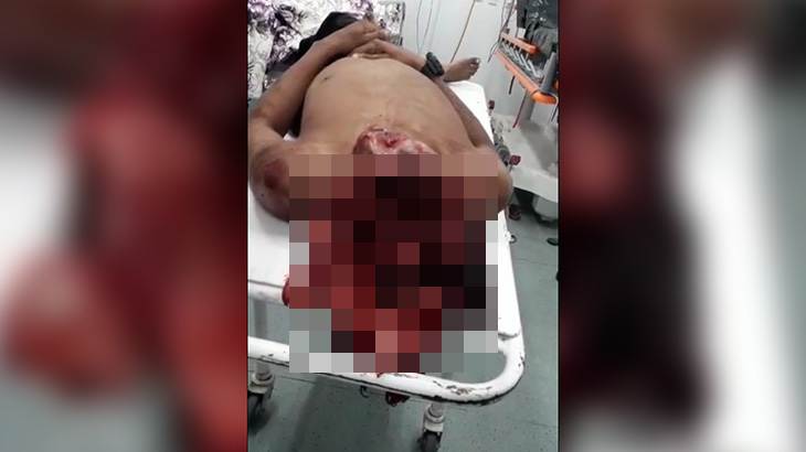 【閲覧注意】頭の中カラッポになって死んだ男のグロ動画･･･。