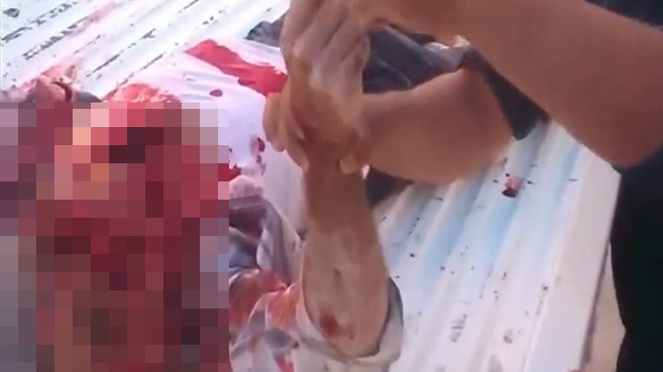 【閲覧注意】砲撃を受けた男性の顔、ヤバい姿に･･･。