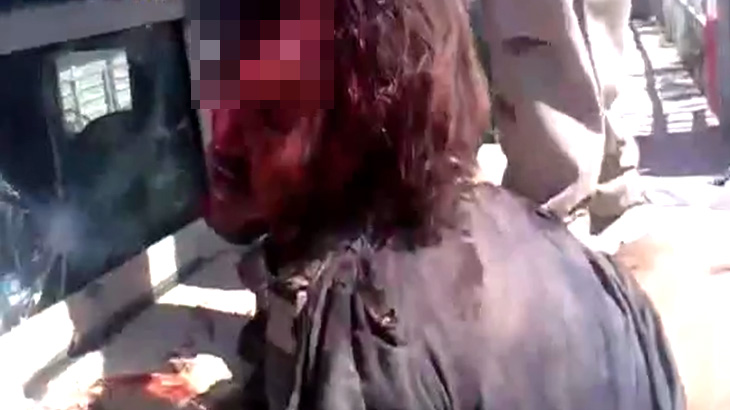 【閲覧注意】レイプされた後、頭を破壊されて殺された男のグロ動画･･･。