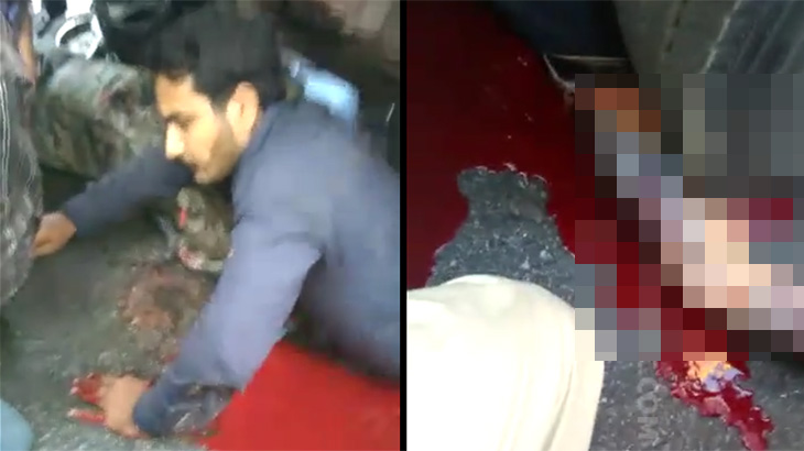 【閲覧注意】トラックに轢かれて脚の筋肉が剥き出しになってしまった男のグロ動画･･･。