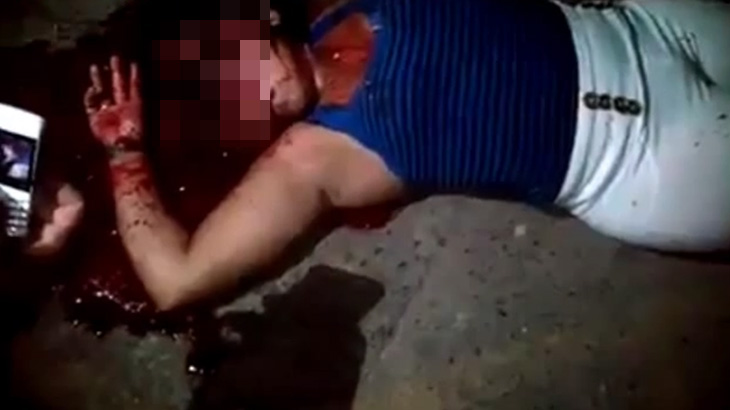 【閲覧注意】事故で頭の中がカラッポになって死亡した女性のグロ動画。