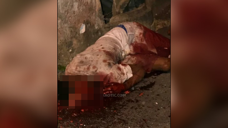 【閲覧注意】ショットガンで顔を撃たれた男、グチャグチャ･･･。