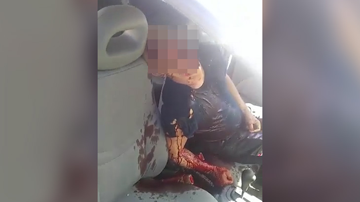 【閲覧注意】ギャングに銃殺された警察官、目玉飛び出してる･･･。