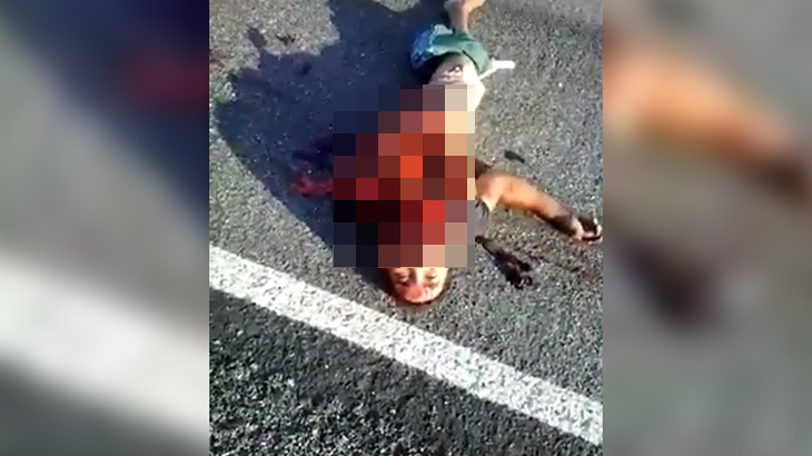 【閲覧注意】事故で死んだ男の身体、縦半分に切断されてしまう･･･。