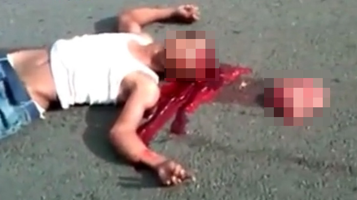 【閲覧注意】ノーヘルでバイク事故を起こした男、脳がまるごと外に飛び出して死亡･･･。