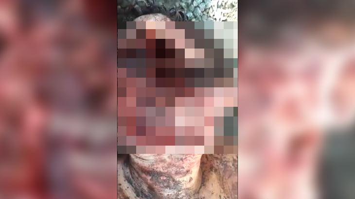 【閲覧注意】顔が無くなった男。