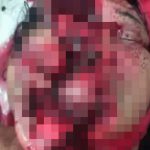 【閲覧注意】女性ライダーが転倒して縁石に顔をぶつけた結果･･･。