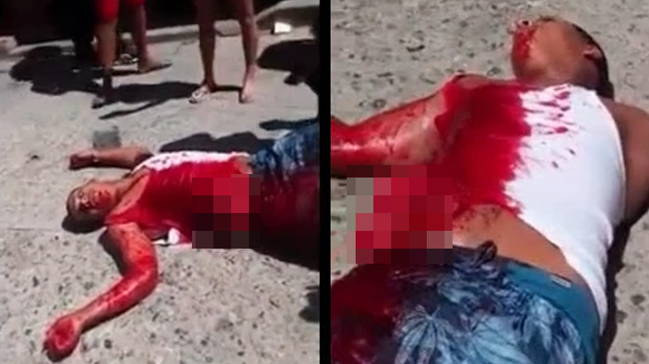 【閲覧注意】警察官に撃たれた強盗、腸が飛び出てしまう･･･。