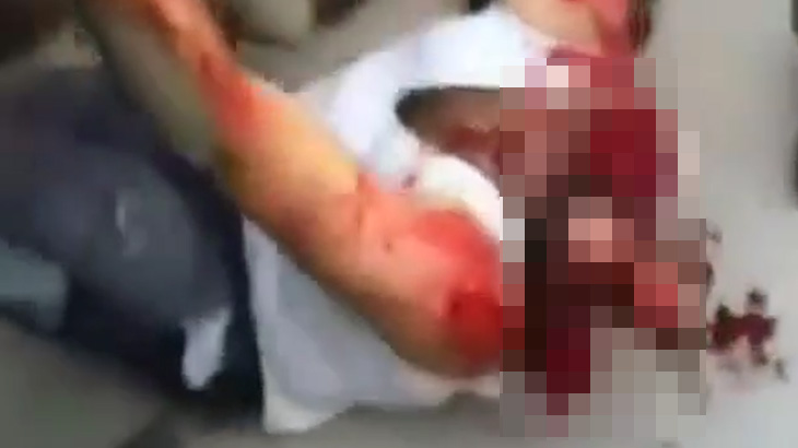 【超！閲覧注意】砲撃により “頭を吹き飛ばされた” 男のグロ動画･･･。