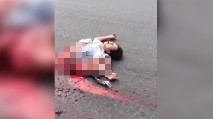 【超！閲覧注意】胸から下がグッチャグチャの女性、まだ生きてる･･･。