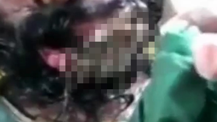 【閲覧注意】口を大量のウジ虫に食われてしまっている男のグロ動画･･･。