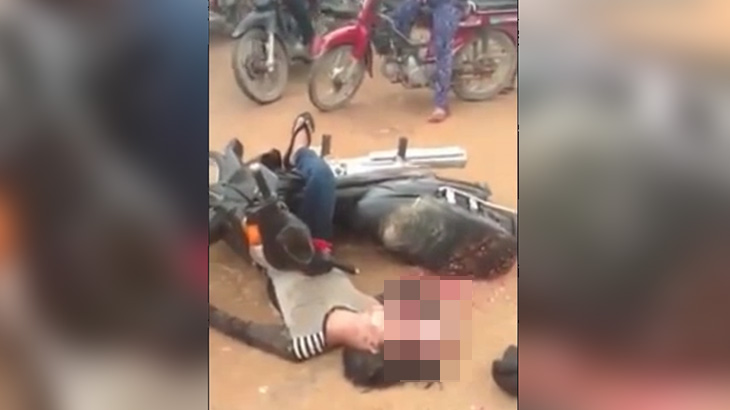 【閲覧注意】事故で死亡した男性、頭蓋骨が割れて脳が飛び出しているグロ動画。