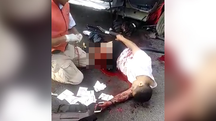 【閲覧注意】事故に遭った男性の太もも、骨が飛び出てる･･･。