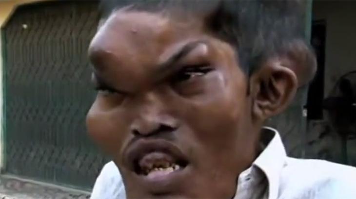 【衝撃映像】まるで “ぬらりひょん” のような顔をした男･･･。