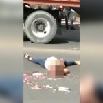 【閲覧注意】トラックと衝突した女性、頭が割れ脳が飛び散ってしまう･･･。