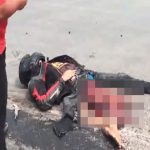 【閲覧注意】事故ったバイカーさん、右脚の皮膚が剥がれて筋肉むき出しに･･･。