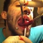 【衝撃映像】舌先を2つに切り裂くスプリットタンを自分でやってしまう男。