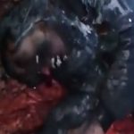 【閲覧注意】脚の太ももの肉?け無くなっている焼死体･･･。