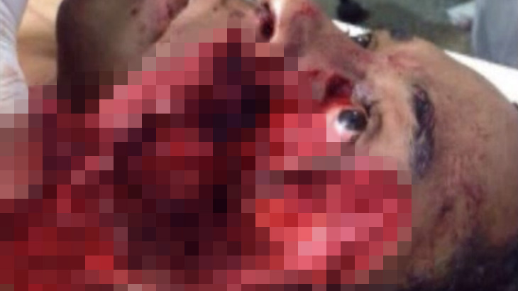 【閲覧注意】ロデオ中に牛から振り落とされて脚で顔を破壊されてしまったグロ動画･･･。